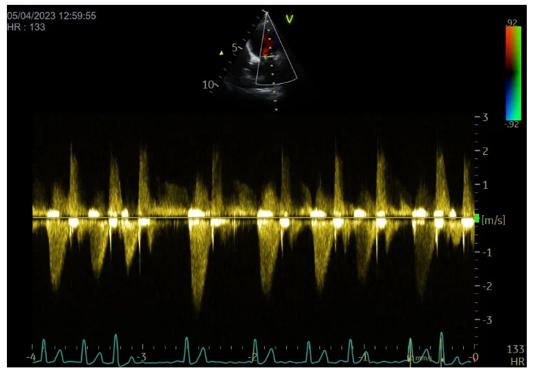 Continuous wave doppler image courtesy of Dave Dickson at Heart Vets