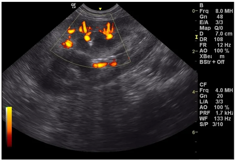 IMV Imaging image of power doppler