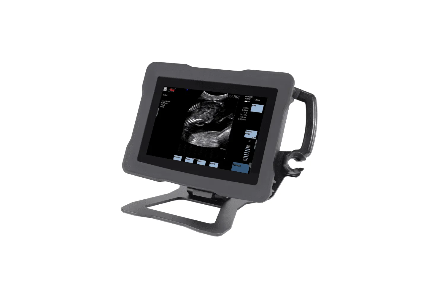 Exapad Micro Veterinary ultrasound scanner