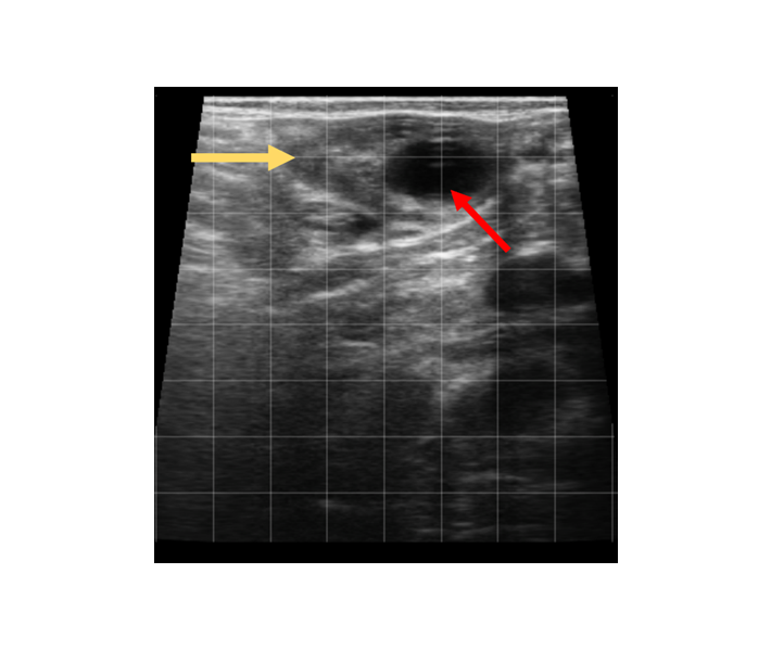 Ultrasonographybovineovary3